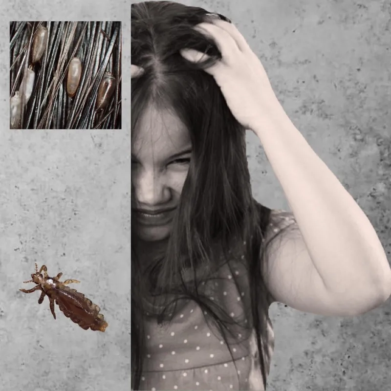 Chân con chấy dưới kính hiển vi có móc