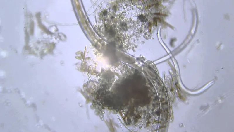 Cách làm tiêu bản nước để quan sát