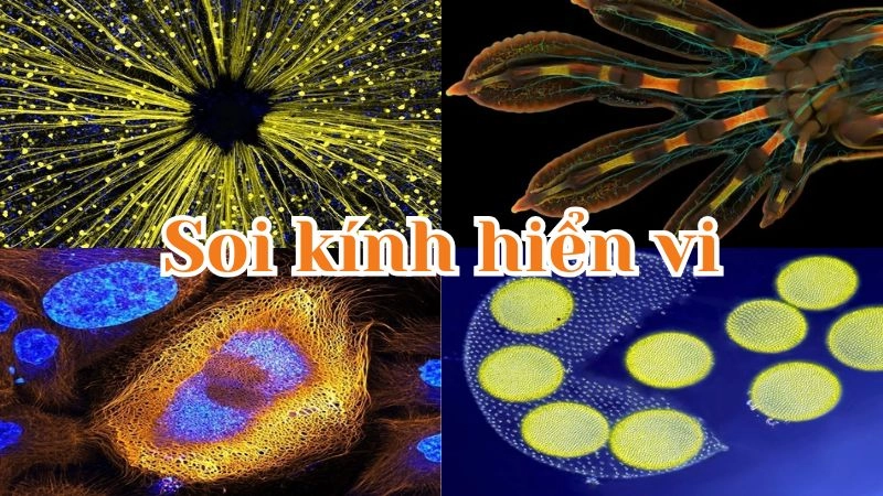 Vẻ đẹp tiềm ẩn của thế giới vi mô dưới kính hiển vi