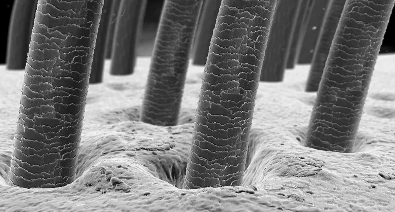 Lớp biểu bì sợi tóc (cuticle) bảo vệ