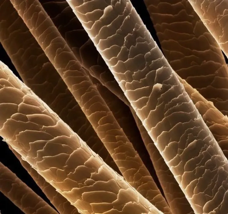 Tủy tóc (medulla) ở trung tâm