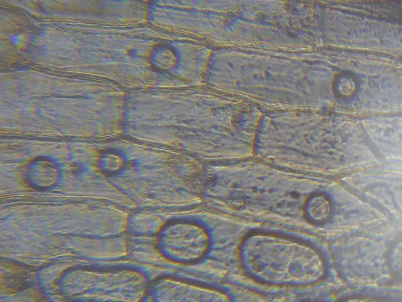 Công thức nhuộm lugol cho tiêu bản