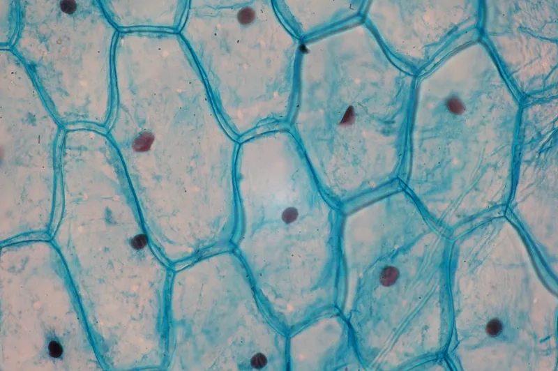 Hình ảnh tế bào hành tây nhuộm iốt