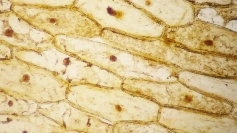 Tế bào chất hành tây bao quanh không bào