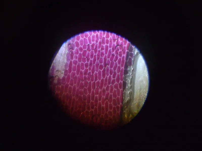 Không bào tế bào hành tây kích thước lớn