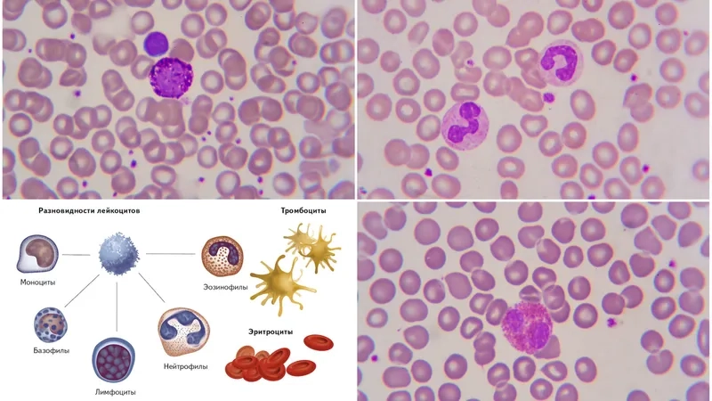 Phết máu ngoại vi để quan sát hình thái