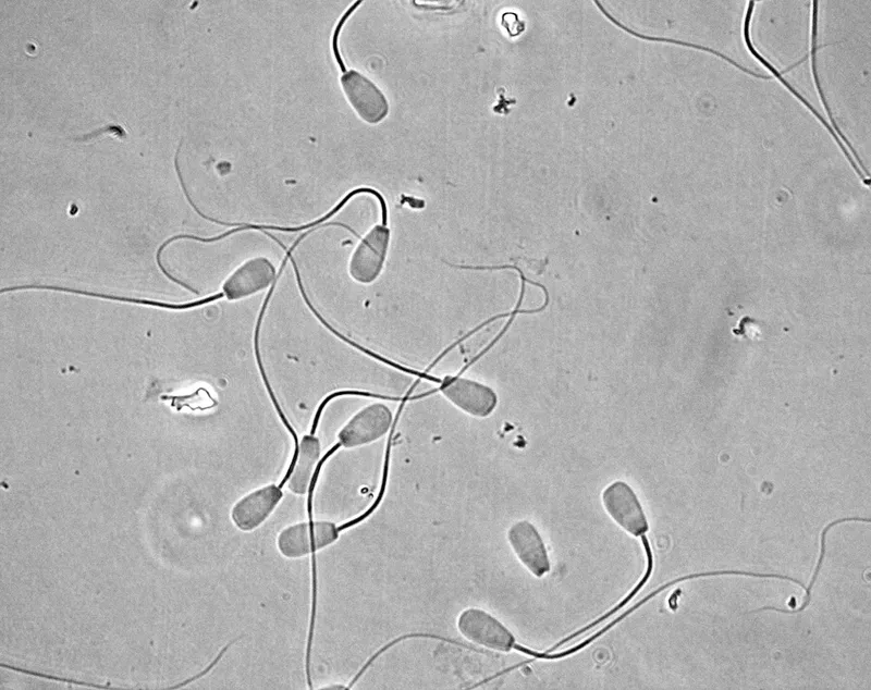 Hình ảnh tinh trùng đang di động