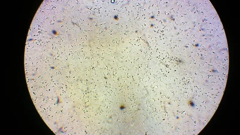 Hình ảnh tinh trùng bất thường dưới ánh sáng