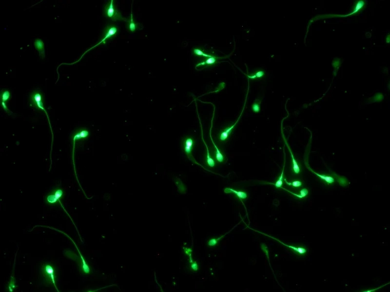 Độ phóng đại xem tinh trùng cần thiết