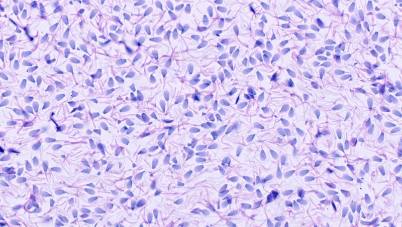 Kiểm tra tinh trùng về số lượng và chất lượng