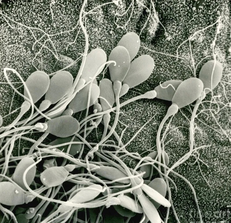 Tinh trùng yếu di chuyển chậm