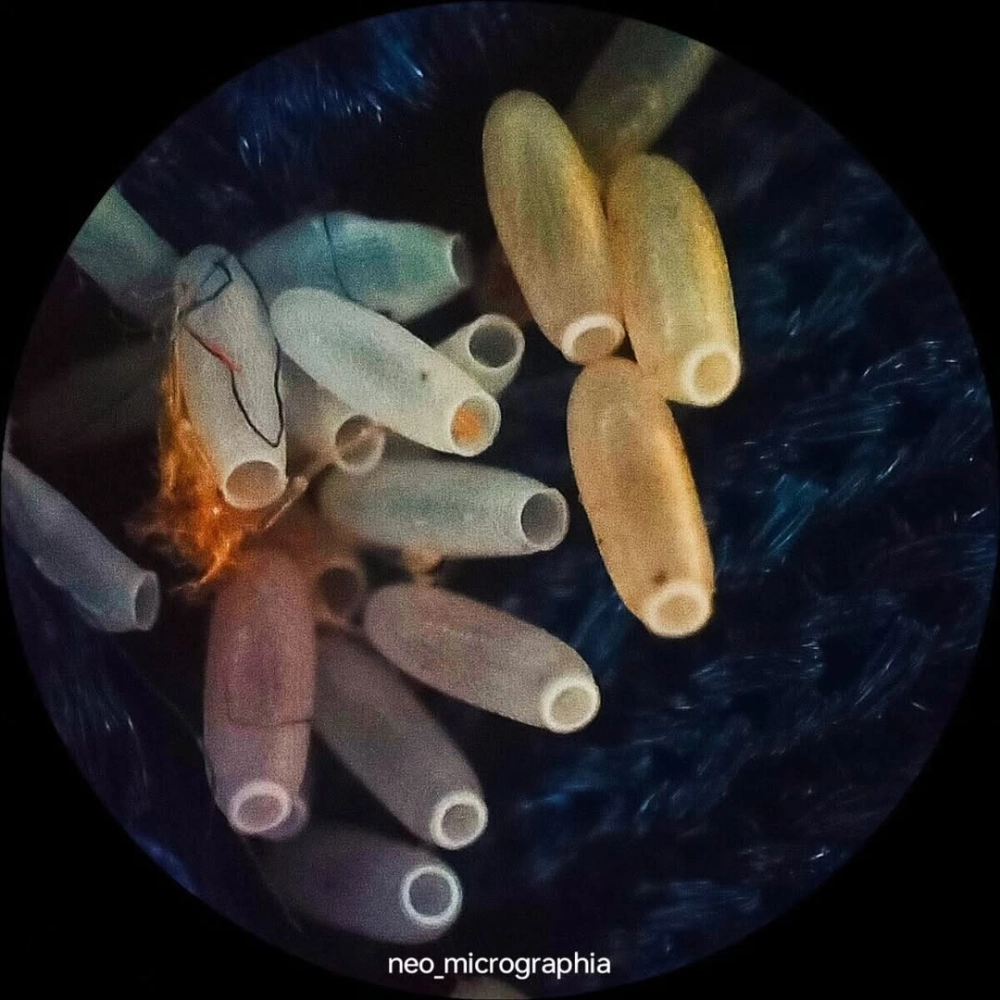 Những quả trứng bọ xít xếp hàng đều tăm tắp trên mặt lá xanh