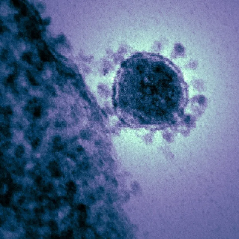 Hình dáng virus corona hình cầu