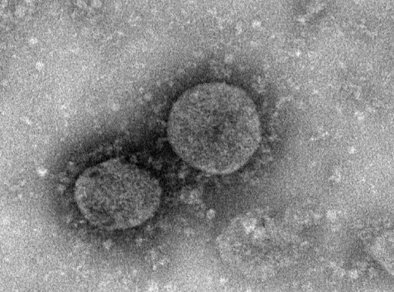 Virus corona là gì họ virus gây bệnh hô hấp