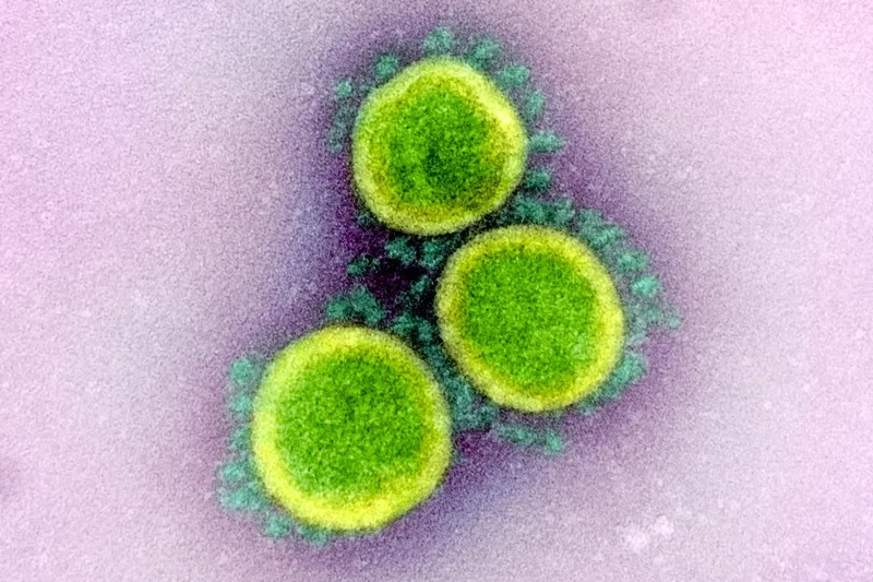 Virus corona chụp bằng kính hiển vi điện tử
