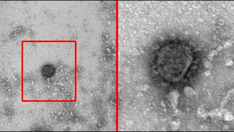 Gai protein virus corona (protein S)